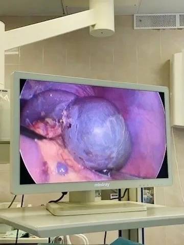 WgNB7yQtOyZe5PKSWQu5IajqVhm4G9Lqif7h5dYqvkc4MYzhZ-LPV5g0O3lr0wwNKiAoycZrgTzTc0v_be_EheQ8.jpg WgNB7yQtOyZe5PKSWQu5IajqVhm4G9Lqif7h5dYqvkc4MYzhZ-LPV5g0O3lr0wwNKiAoycZrgTzTc0v_be_EheQ8.jpg