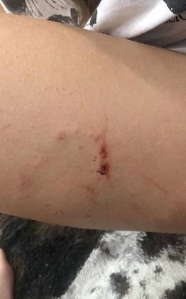В Сосногорске организовали проверку после нападения собаки на девочку