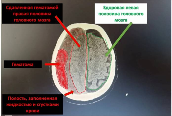 X4aPKtsHji4gDWpoHqGGPY87jFcSQvz7v2P5JKvvK1zt-Lx26F-1QsisZCXQNJE4_Pq3emQb5Jh6jhxdyookhDf1.jpg X4aPKtsHji4gDWpoHqGGPY87jFcSQvz7v2P5JKvvK1zt-Lx26F-1QsisZCXQNJE4_Pq3emQb5Jh6jhxdyookhDf1.jpg
