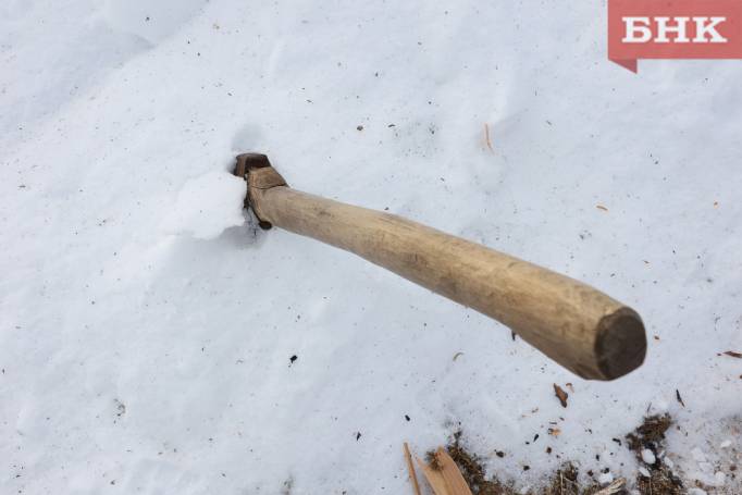 Ижемец выжил после удара колуном по голове