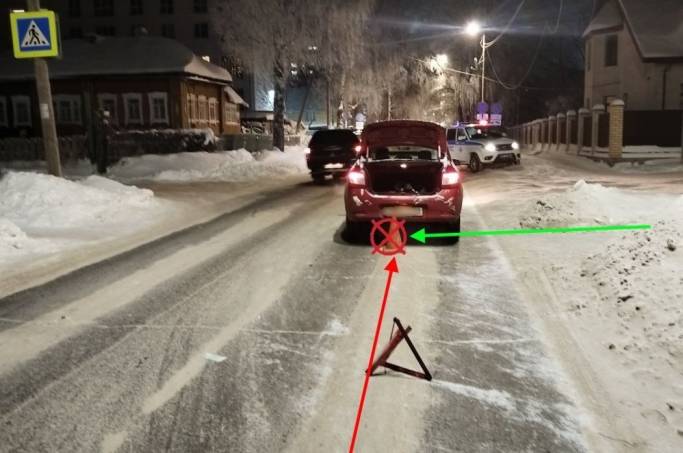 В Сыктывкаре восьмилетняя девочка попала под колеса иномарки