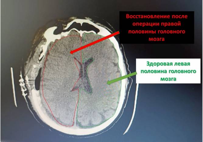 47aGiZKRBroQsw-wH4y66EzklKgrKJi2_w2s9oe5aDHo-PmTQkSFUMJwKJCc-2FEaTdftXgPfzBulNVBomIf_Ncg.jpg 47aGiZKRBroQsw-wH4y66EzklKgrKJi2_w2s9oe5aDHo-PmTQkSFUMJwKJCc-2FEaTdftXgPfzBulNVBomIf_Ncg.jpg