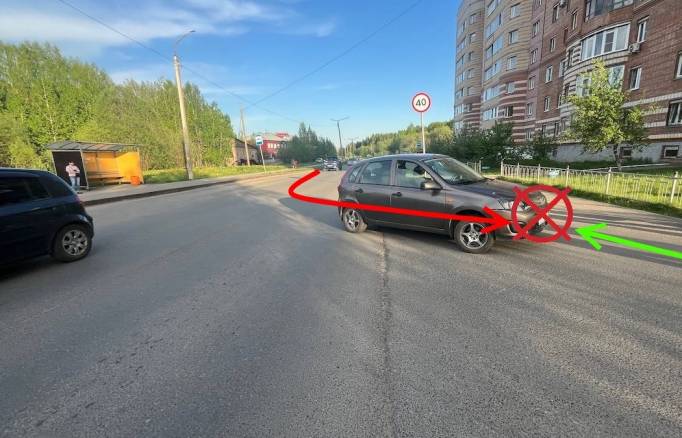 В Сыктывкаре мужчину на электросамокате сбил автомобиль